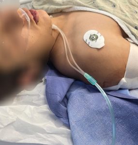 הנער שנפצע קשה מייר צהל בבנימין