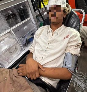 מתיישב שנפצע בלינץ' סמוך לכרמל